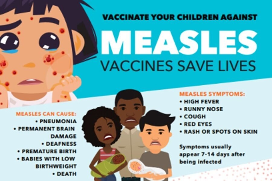 Ministry of Health and Human Services Confirm Two Measles Cases 